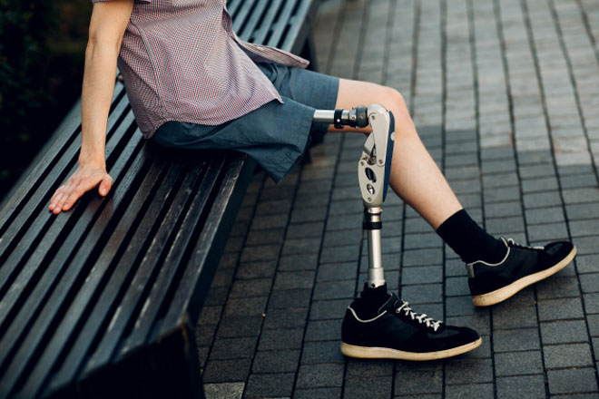 Man with a 3D printed leg